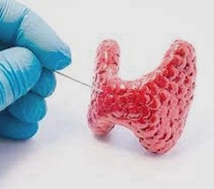 Punção guiada de nódulos de tireoide (PAAF) – saiba mais